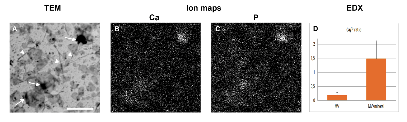 TRANSMISSION ELECTRON MICROSCOPY OF MATRIX VESICLES AND COLLAGEN FIBERS AND X-RAY ELEMENTAL MAPS OF CALCIUM AND PHOSPHORUS IN MATRIX VESICLES